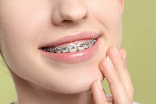 What Foods Are Off Limits During Braces Treatment?