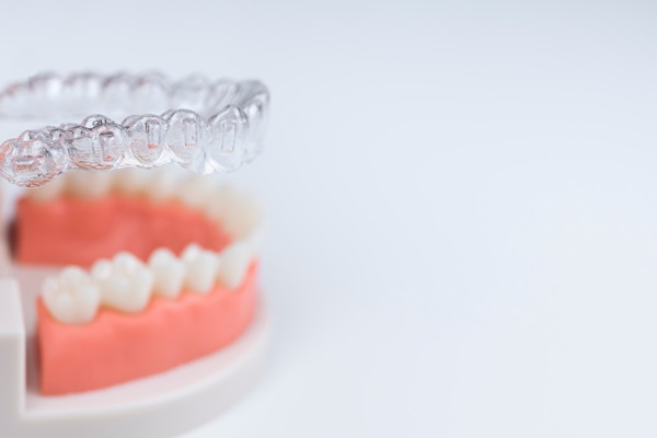 How Long Does It Take For Clear Braces To Straighten Your Teeth?