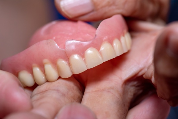 Denture Stomatitis: What It Is And How To Prevent It