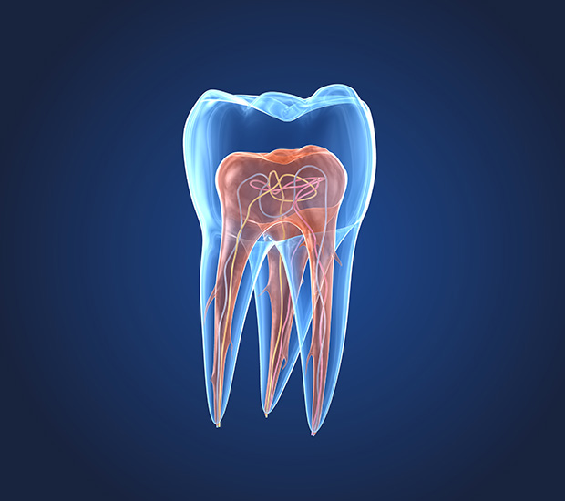 Jackson Heights What is an Endodontist